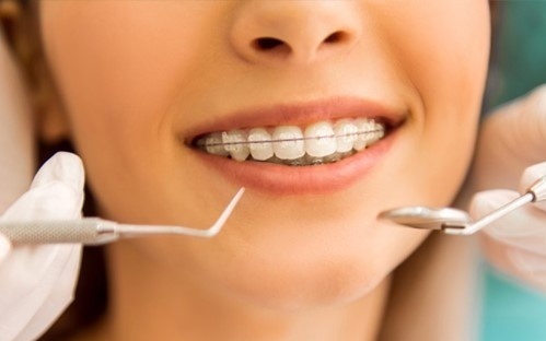 اکلوژن چیست؟