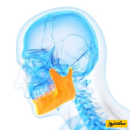 استئونکروز استخوان فک چیست؟