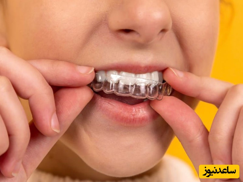  درمان مشکلات دندانی با ارتودنسی شفاف!