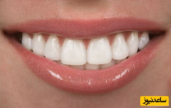 نکاتی برای مراقبت از دندان و لثه