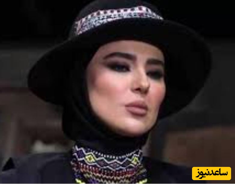 شیدا یوسفی، بازیگر بامداد خمار: مجبور شدم کامپوزیت‌های دندانم را بردارم+ویدیو