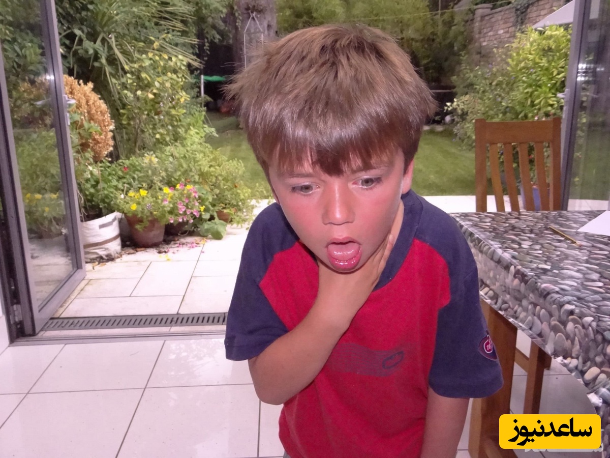 غذا و اجسام گیر کرده در گلوی کودک را چگونه خارج کنیم؟