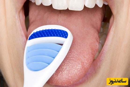 مسواک زدن زبان چه نقشی دارد؟