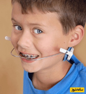 رفع مشکلات دندان با ارتودنسی فانکشنال امکان پذیر است؟