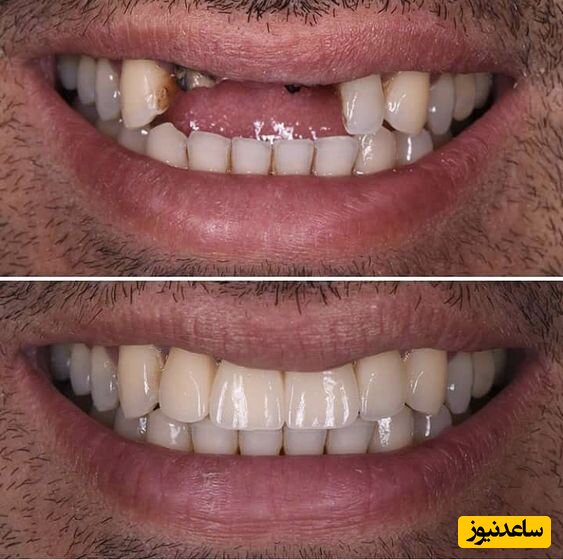 ترمیم و عصب کشی دندان حتی در روزهای تعطیل