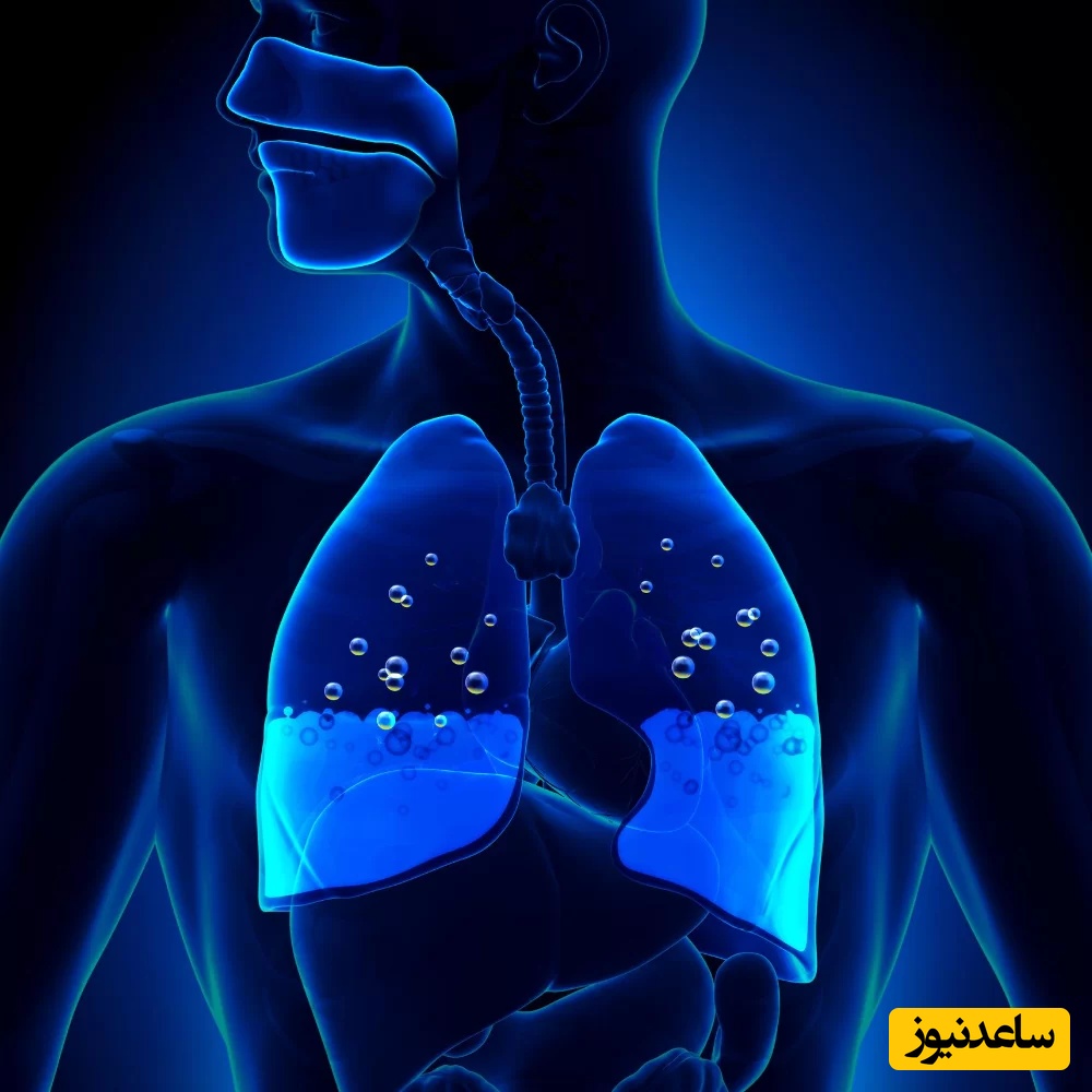 آب آوردن ریه (ادم ریوی)؛ علل، علائم و جدیدترین راهکارهای درمانی