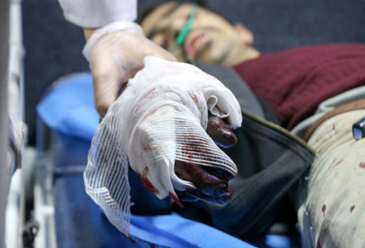 714 مصدوم و 16 کشته در مراسم چهارشنبه سوری امسال تاکنون