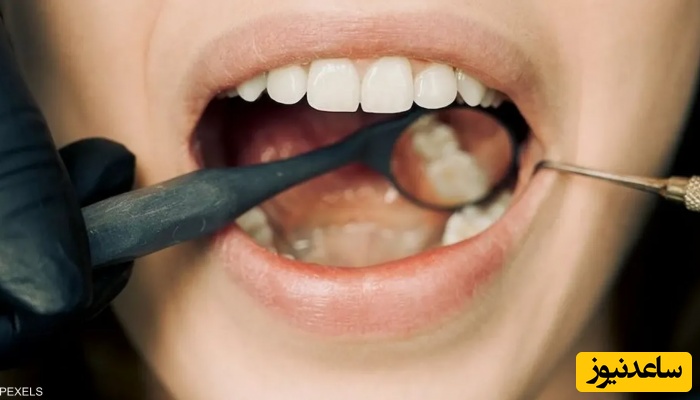 تدابیر دندانپزشکی برای بیماران سرطانی چیست؟