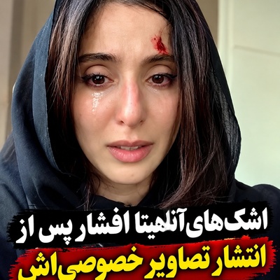 انتشار فیلم خصوصی لورفته از وضعیت نامناسب آناهیتا افشار همه را نگران کرد/ اشک‌های خانم بازیگر فضای مجازی را به هم ریخت