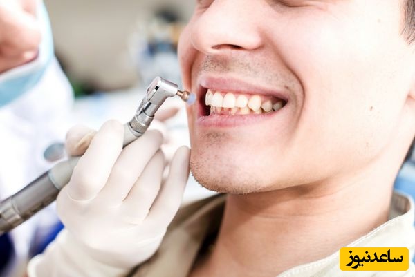 دلیل حساس شدن دندان ها بعد ازانجام کامپوزیت چیست؟