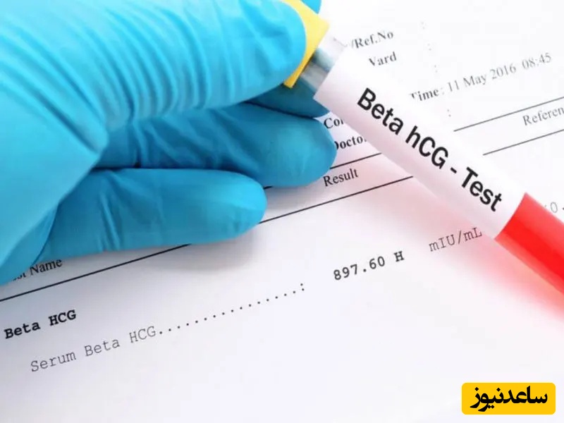 میزان نرمال هورمون بتا (hCG) در بارداری
