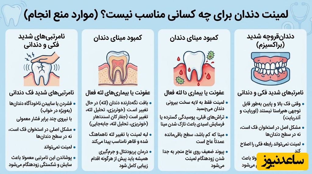 لمینت دندان برای چه کسانی مناسب نیست؟