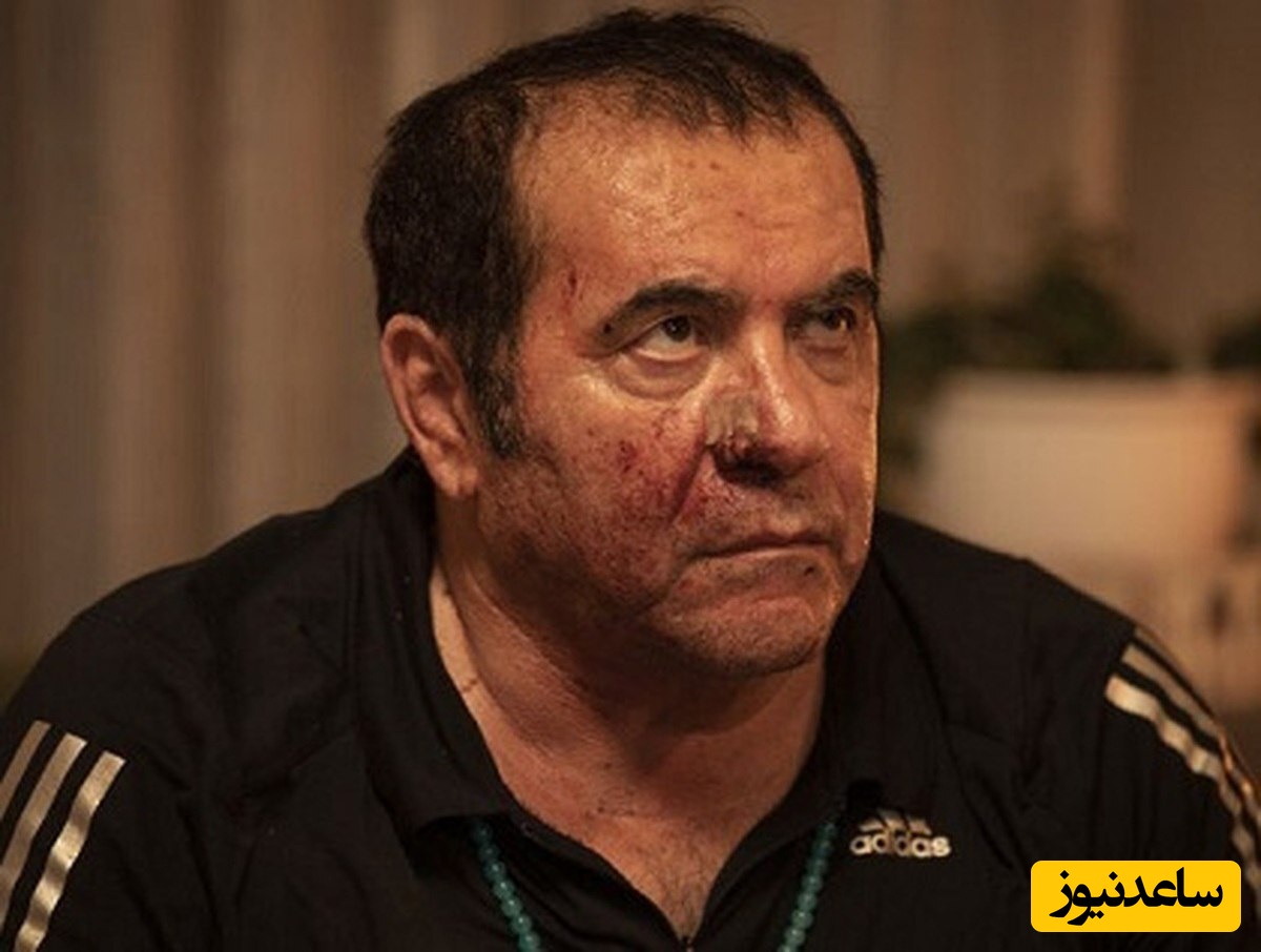 فوت ناگهانی بازیگر فیلم زخم کاری در بیمارستان!