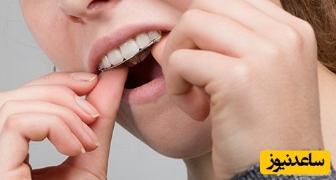 چرا بعد از درمان ارتودنسی دندان ها به حالت اولیه برمیگردند؟