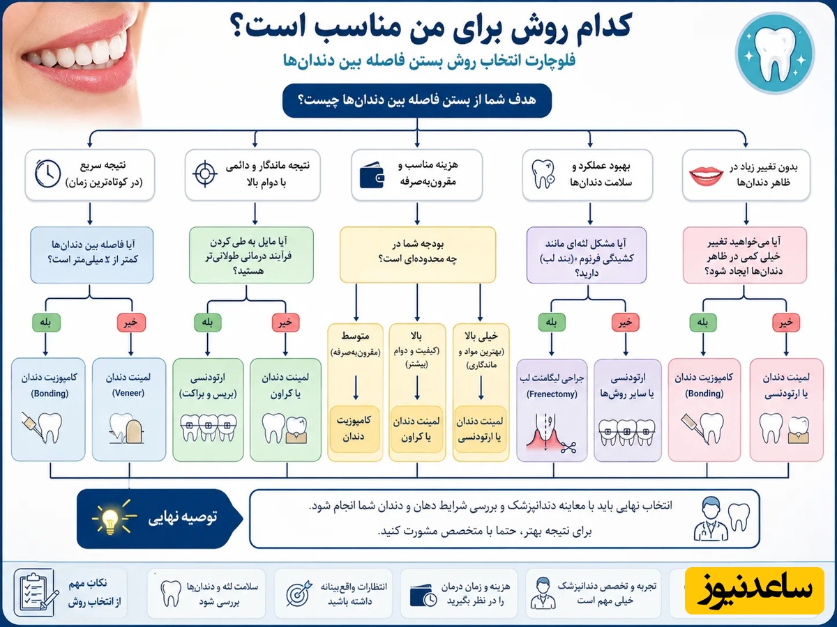کدام روش بستن فاصله دندان مناسب شماست