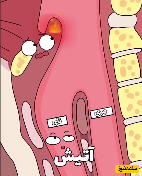 (ویدئو) یک عادت ساده که می‌تواند راه نفس‌تان را در چند دقیقه ببندد!