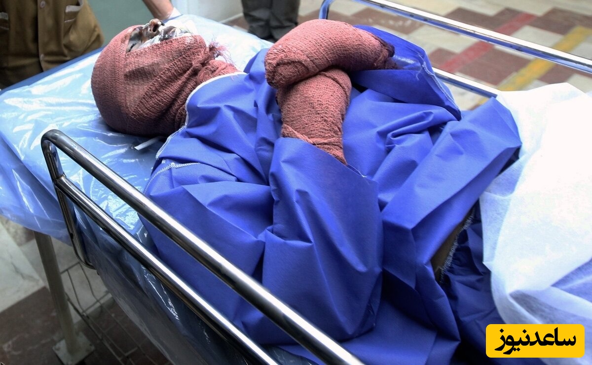 فوت بر اثر اسیدپاشی