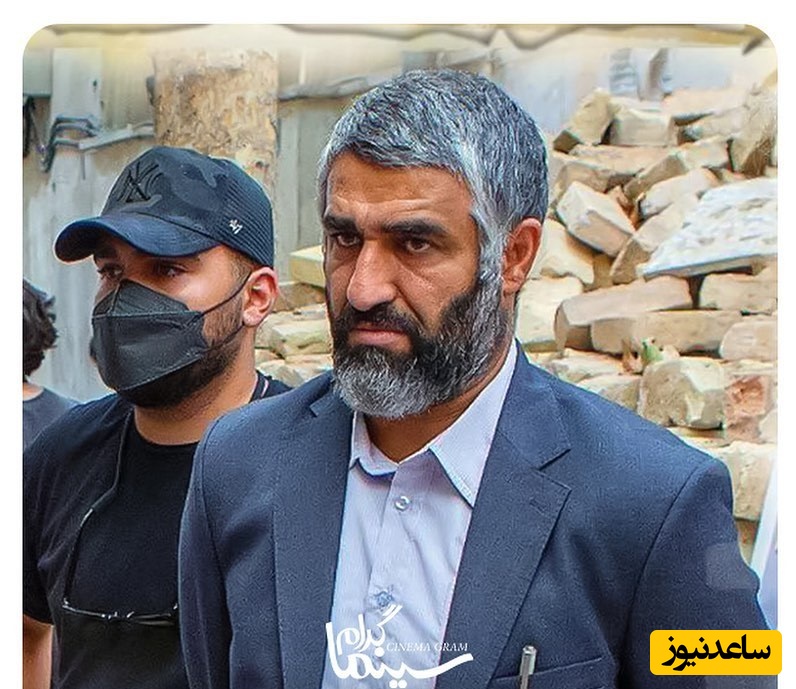 بلایی که بر سر پژمان جمشیدی در مترو تهران آمد؛ یک چشم، پیشانی و دندانش به این وضع درآمد!+عکس