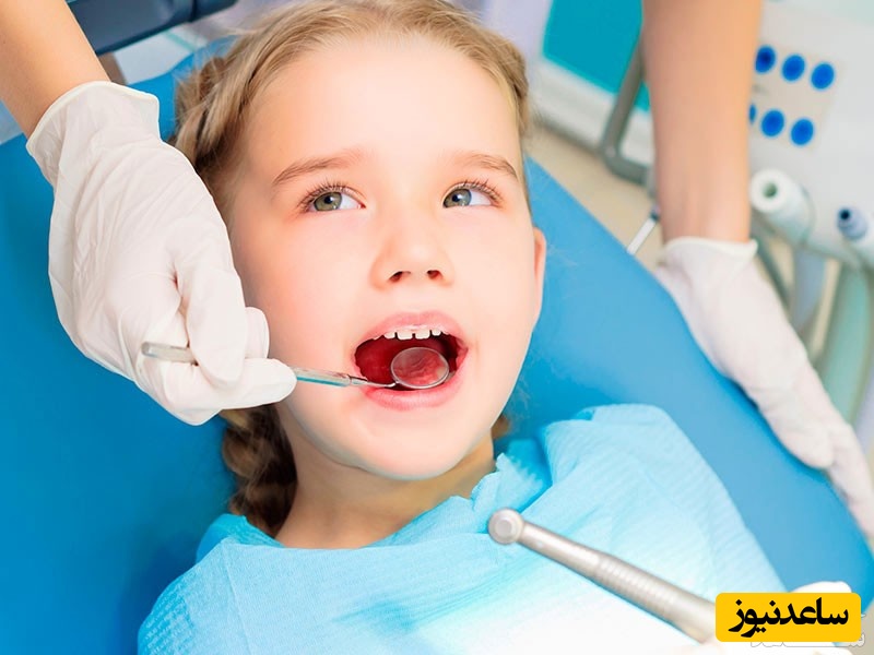 شیار پوش دندان + نکات مهم