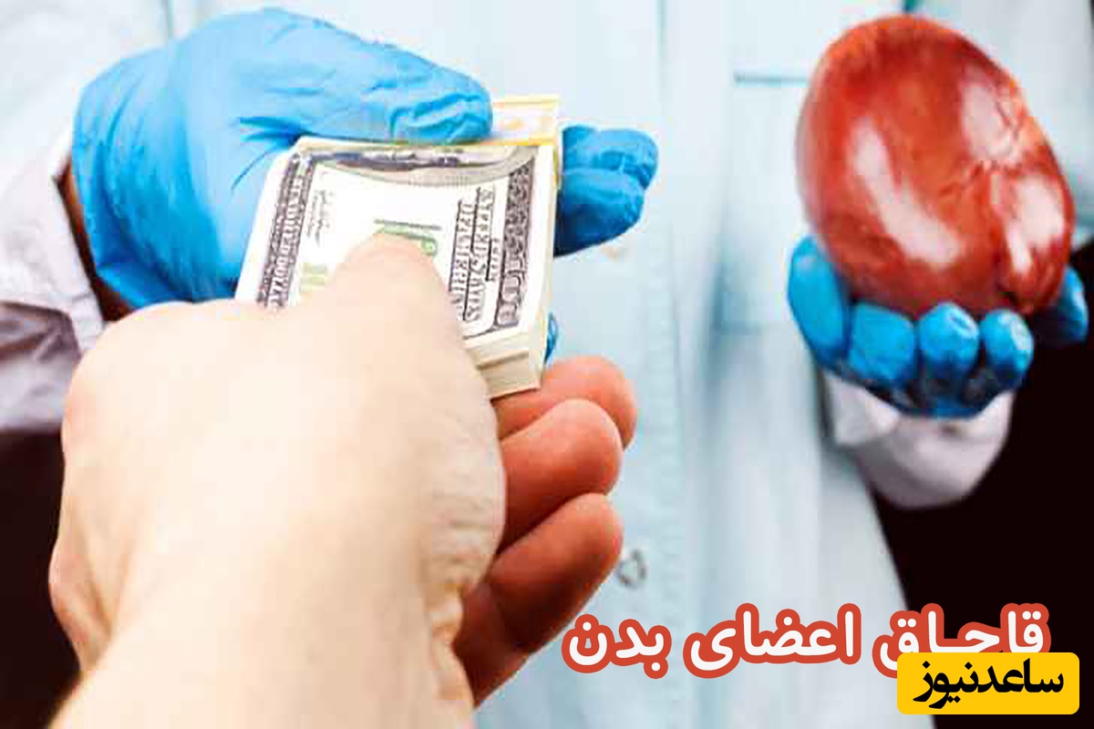 دستگیری 7 مرد ایرانی و عراقی بخاطر قاچاق اعضای بدن / 20 نفر در شهر ری بطرز وحشتناکی جراحی شدند + جزئیات