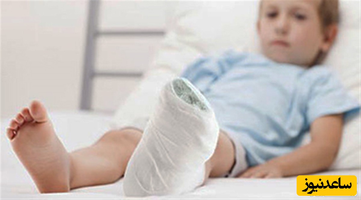 گچ گرفتگی پای کودک