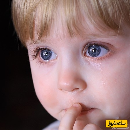 علائم انسداد مجرای اشکی در کودکان