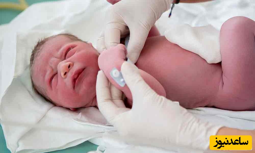 نمره آپگار نوزاد چیست؟