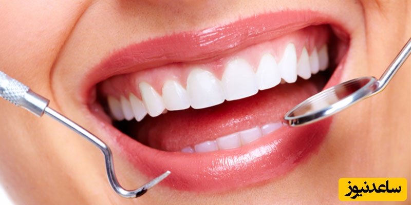 آیا کامپوزیت خوب است یا خیر؟