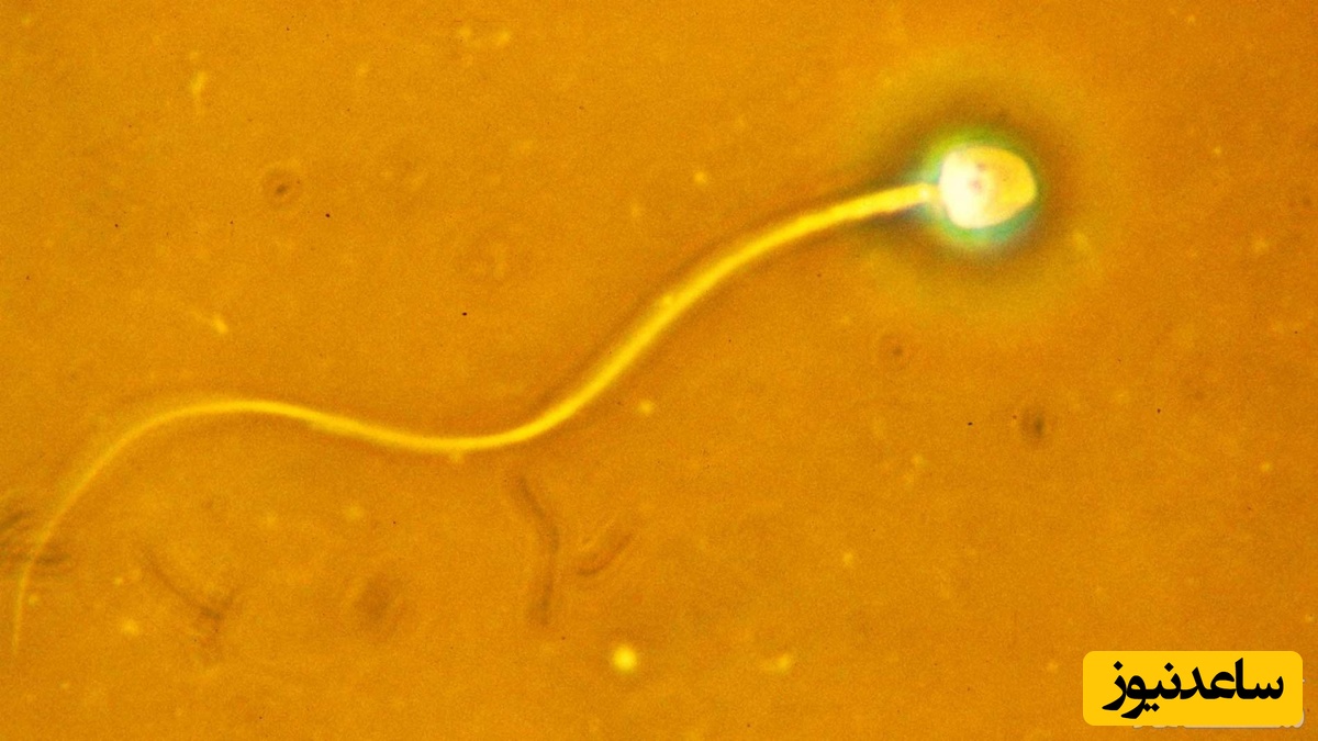 دلایل زرد شدن مایع منی در مردان و روش‌های درمان