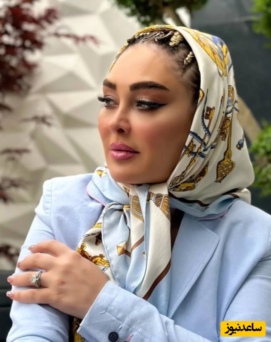 نتیجه تزریق ها و بوتاکس ها بر روی صورت الهام حمیدی!😏