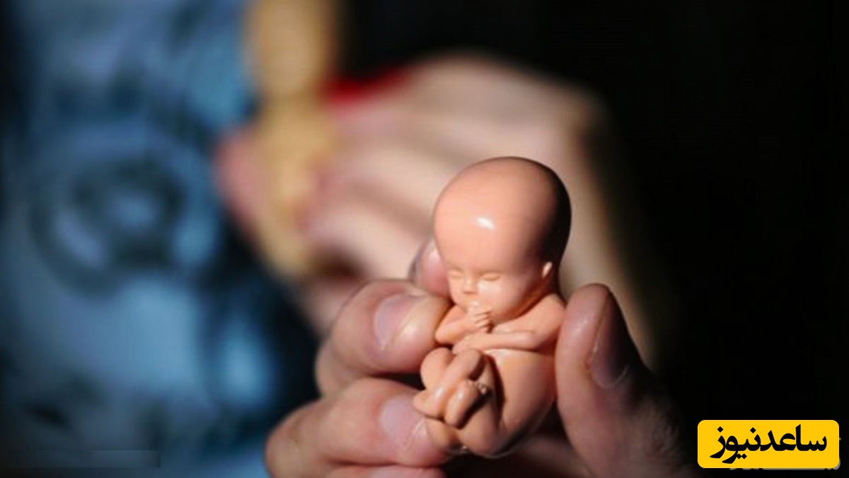 همه چیز در مورد سقط قانونی جنین و نکات حقوقی آن