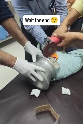 فیلم | لحظه نفسگیر نجات خردسالی که سرش در قابلمه گیر کرده / مراقب کنجکاوی کودکان خود باشید