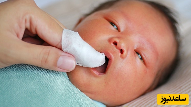 تاثیر پستانک در بهداشت دهان و دندان کودک چیست؟