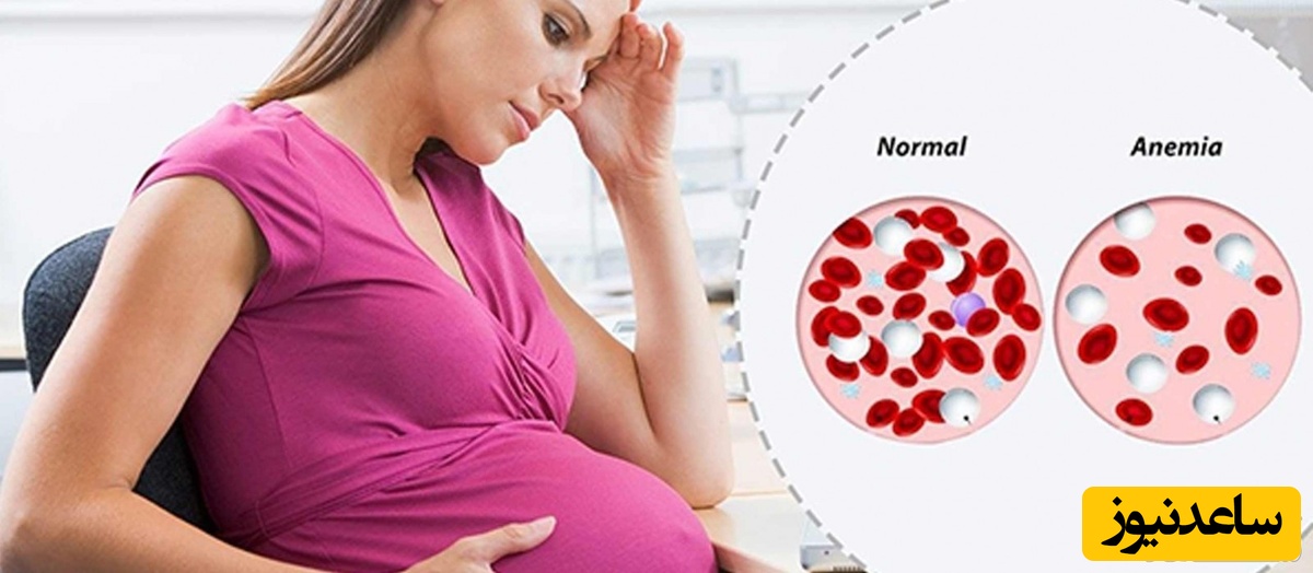 بارداری و زایمان در زنان مبتلا به تالاسمی مینور