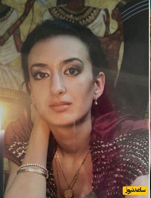 جراحی های عجیب/ دختر زیبایی که عاشق عکسش روی سماور شده بود خودش به تیغ جراح سپرد و نتیجه باورنکردنیه