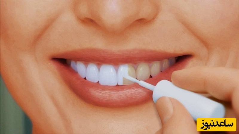 چرا استفاده از سرکه‌‌ی سیب باعث سفیدی دندان ها میشود؟
