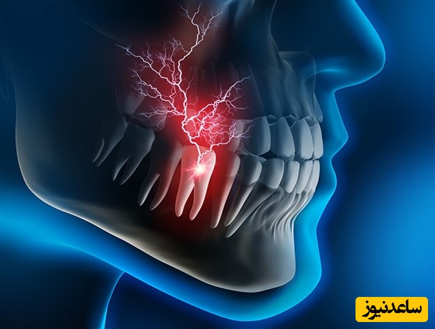درمان فوری دندان درد در خانه