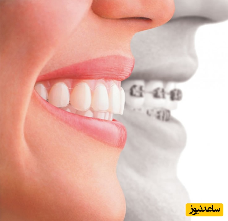 درمان کراس بایت چگونه است؟