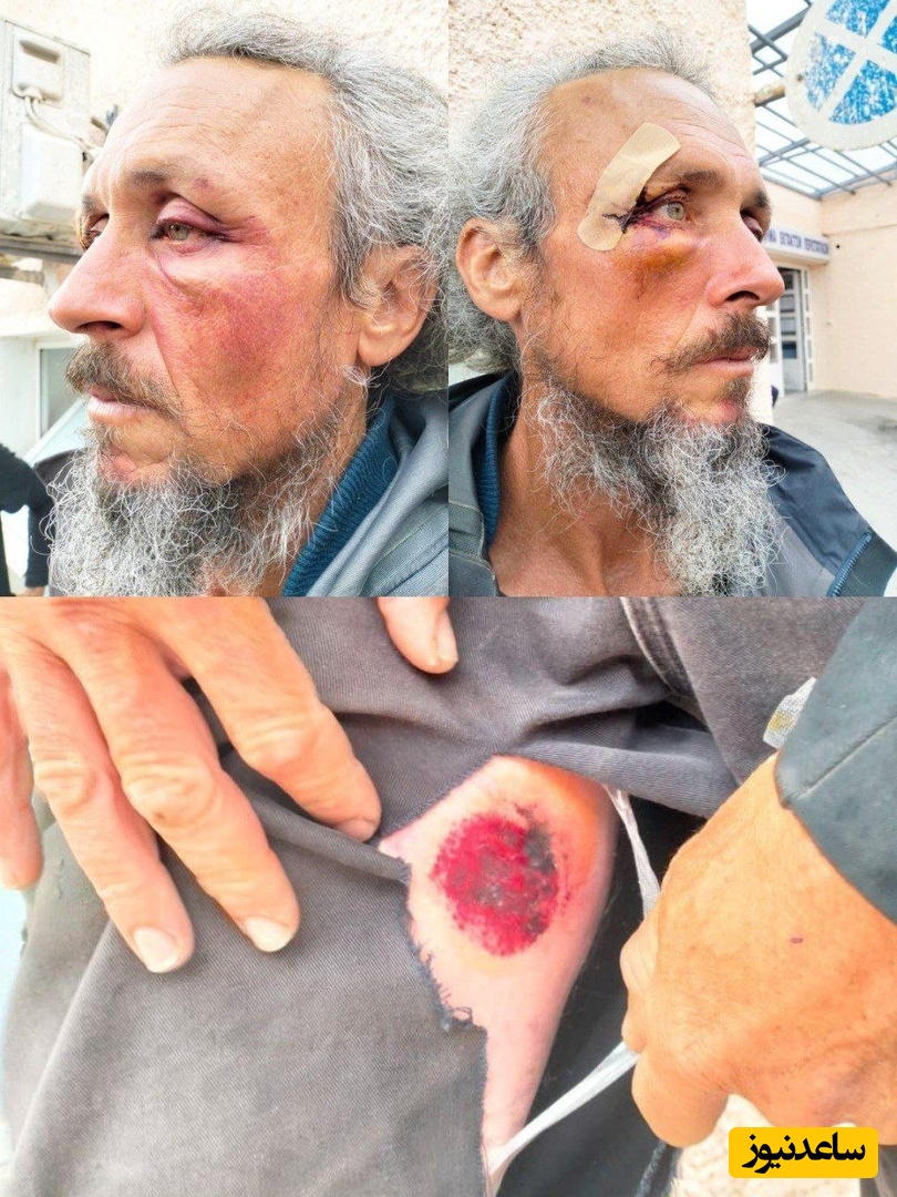 40 ساعت شکنجه وحشیانه توسط اسرائیل فقط به دلیل رساندن کمک به غزه؛ از شکستن استخوان دنده و خوابیدن روی آزمین خیس تا...+تصاویر