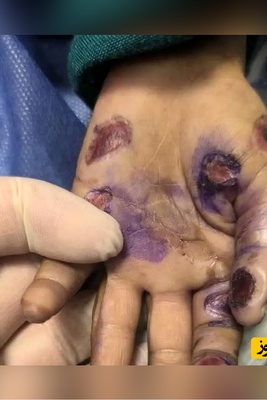 ماجرای مرگ تلخ کودک 4 ساله/ کودک آزاری منجر به فوت شد