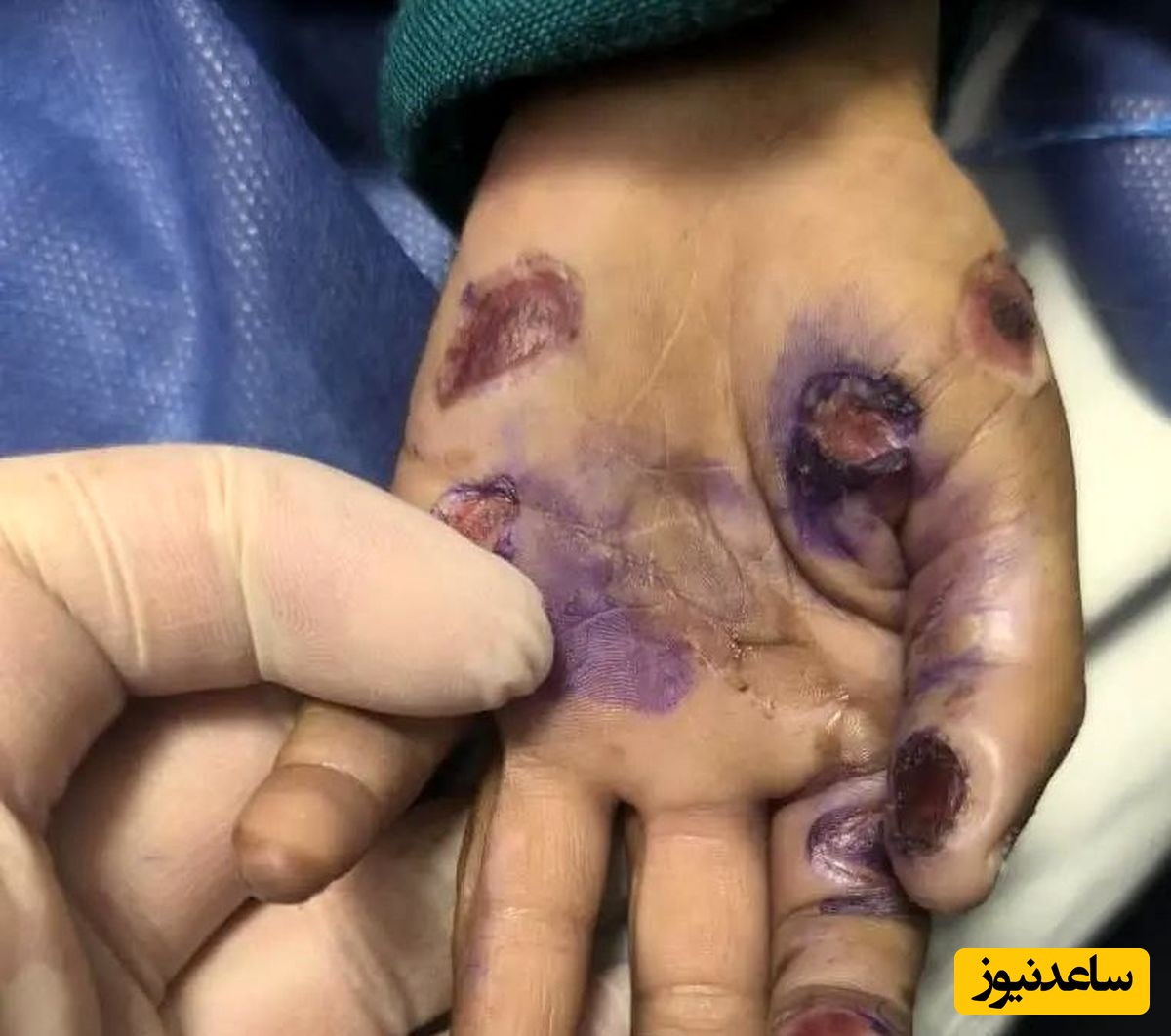 ماجرای مرگ تلخ کودک 4 ساله/ کودک آزاری منجر به فوت شد