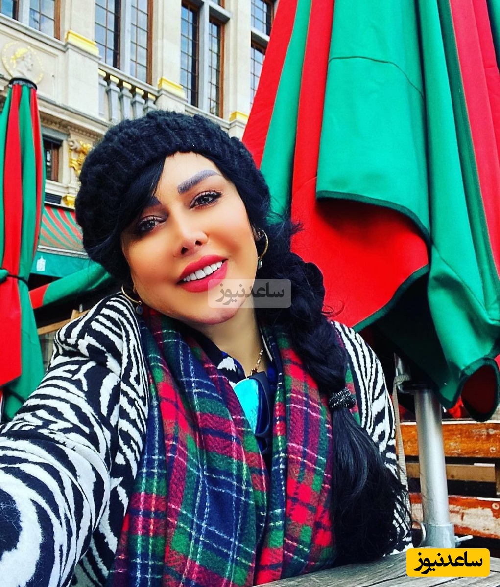 تغییر چهره‌ی فاحش و عجیب فلور نظری بعد از عمل های جراحی متعدد!😮😵