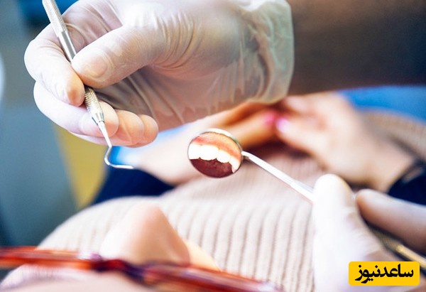 موکوزیت دهانی چیست؟