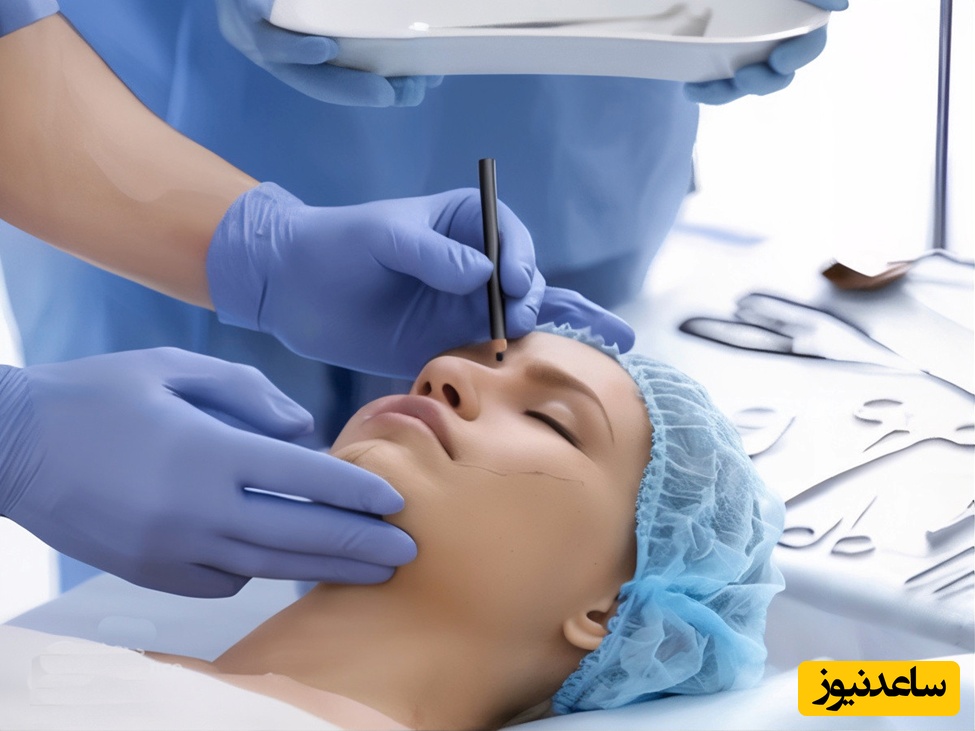 رینوپلاستی چیست و چگونه انجام میشود؟ توضیحات کامل از زبان دکتر حامد عباسی