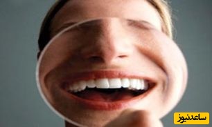 برای سفت شدن دندان لق چه کنیم؟