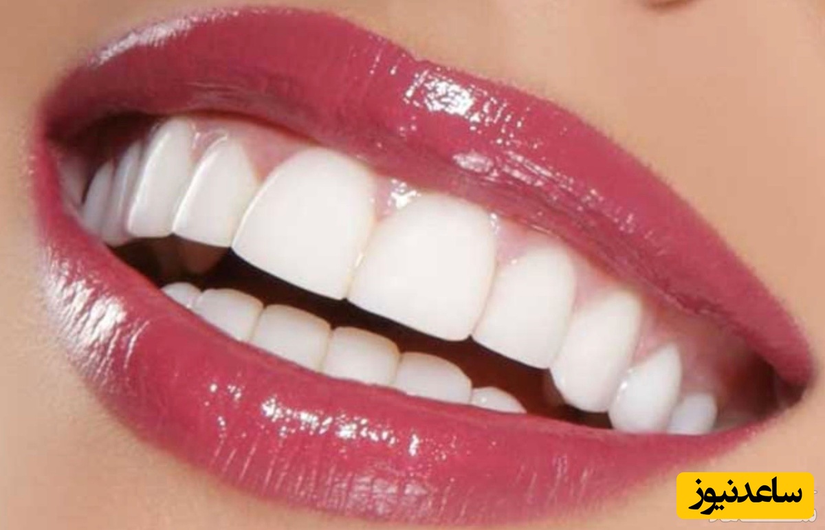 تحلیل لثه علل و درمان آن