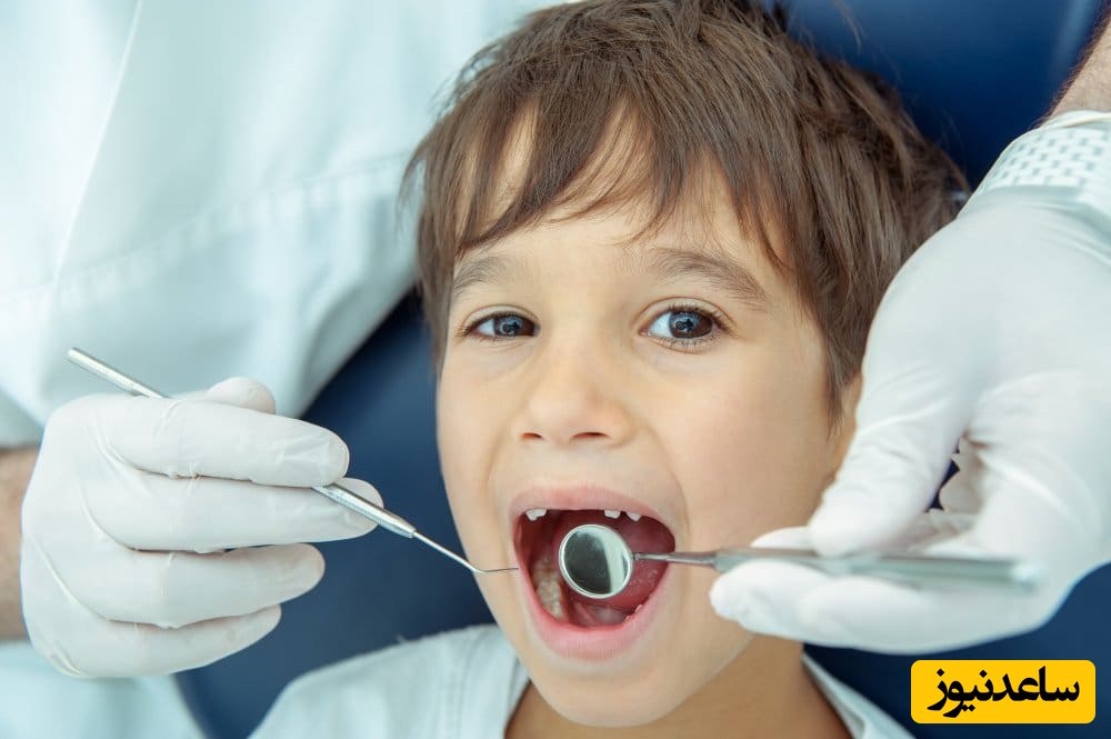 بعد از کشیدن دندان شیری چکار کنیم؟