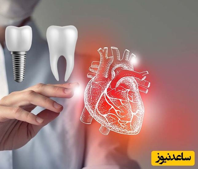ارتباط بین بیماری قلبی و دندان پزشکی