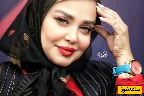 همسر سابق بهاره رهنما: بهاره با پای شکسته و داخل گچ نماز صبح می خواند