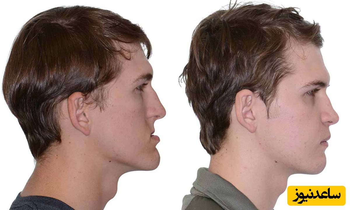 منظور از درمان ارتوسرجری چیست؟